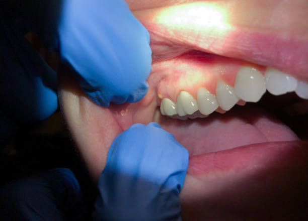 Best Emergency Root Canal Treatment in Perry, KS