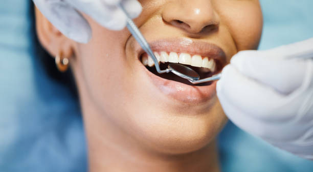 Best Emergency Dental Surgery in Perry, KS